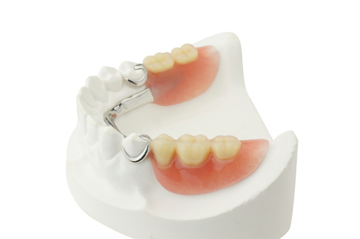 Partial Dentures at Portola Smiles 