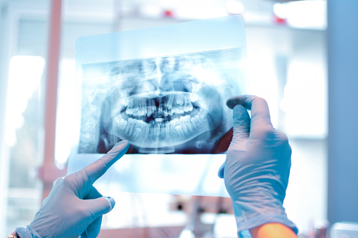 Image of two hands holding a digital xray