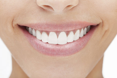 Veneers at Dr. Francine Abad